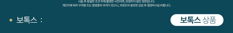 국산 보톡스 상품
