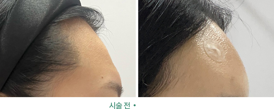 전후사진