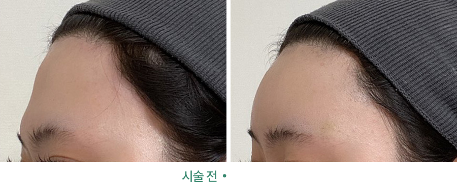 전후사진