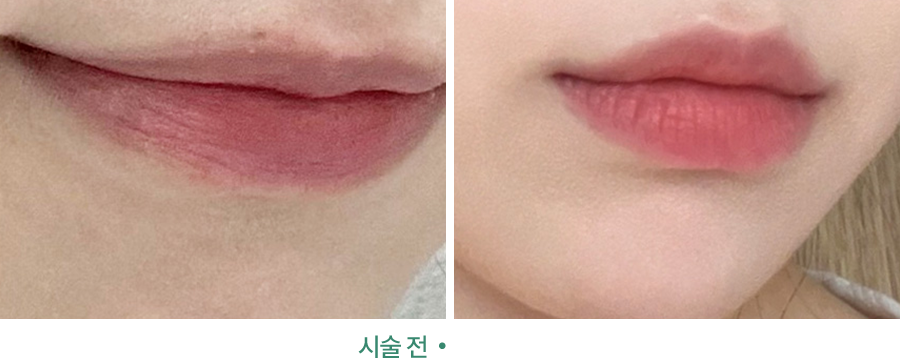 전후사진
