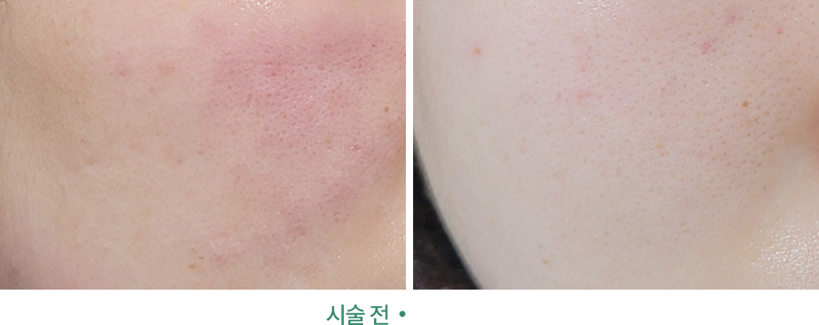 전후사진