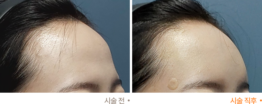 전후사진